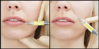 Plasma Gel Maker Biofiller - Stargaze Aesthetic Supplies